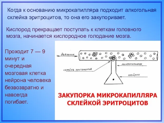 Когда к основанию микрокапилляра подходит алкогольная склейка эритроцитов, то она его закупоривает.