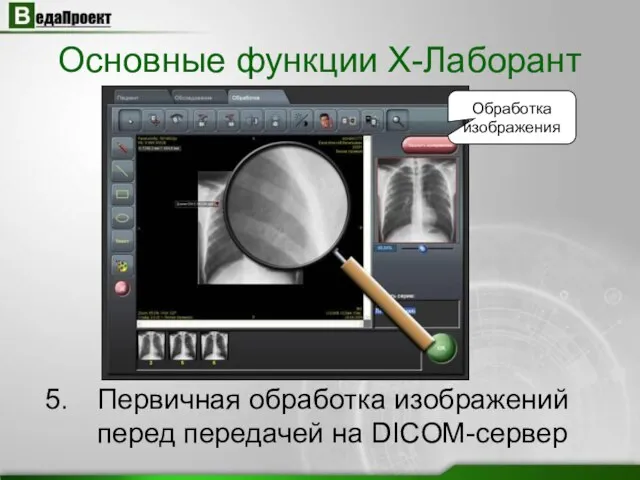 Обработка изображения Первичная обработка изображений перед передачей на DICOM-сервер Основные функции X-Лаборант