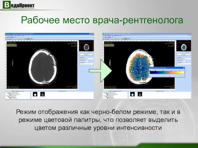 Рабочее место врача-рентгенолога Режим отображения как черно-белом режиме, так и в режиме