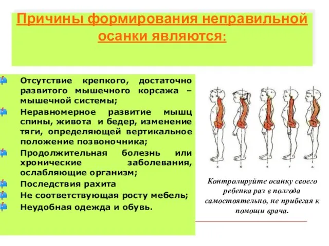 Причины формирования неправильной осанки являются: Отсутствие крепкого, достаточно развитого мышечного корсажа –