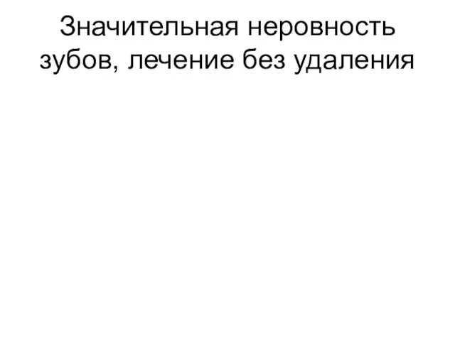 Значительная неровность зубов, лечение без удаления