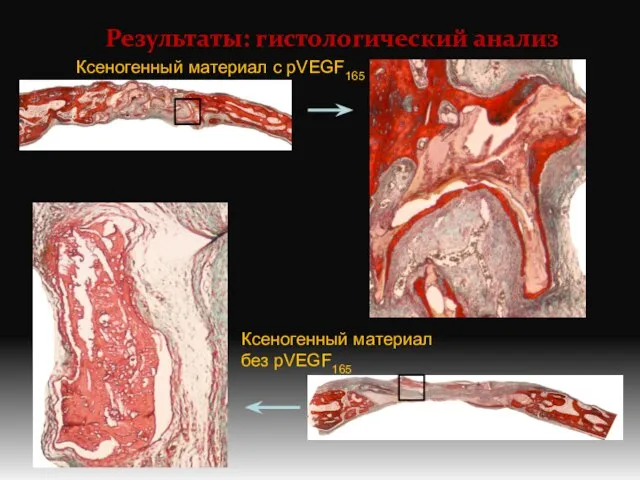 Результаты: гистологический анализ Ксеногенный материал с pVEGF165 Ксеногенный материал без pVEGF165