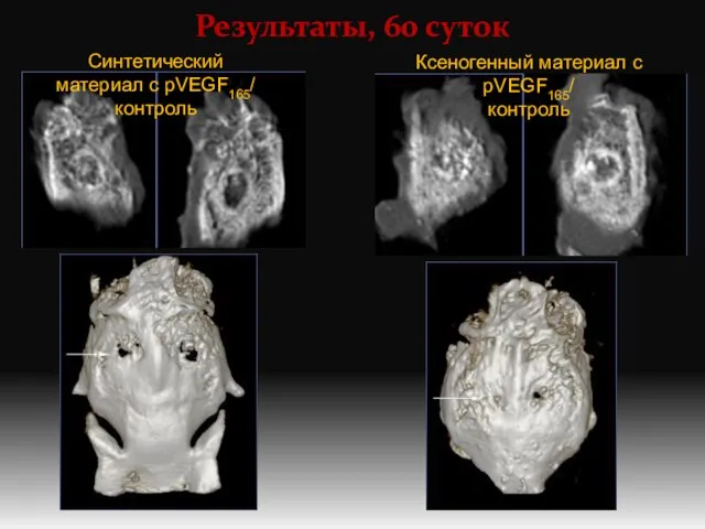 Результаты, 60 суток Синтетический материал с pVEGF165/ контроль Ксеногенный материал с pVEGF165/ контроль