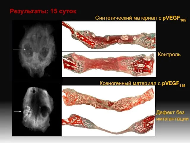 Результаты: 15 суток Синтетический материал с рVEGF165 Контроль Ксеногенный материал с рVEGF165 Дефект без имплантации