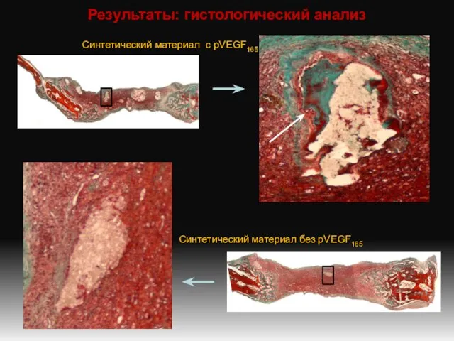 Результаты: гистологический анализ Синтетический материал с pVEGF165 Синтетический материал без pVEGF165