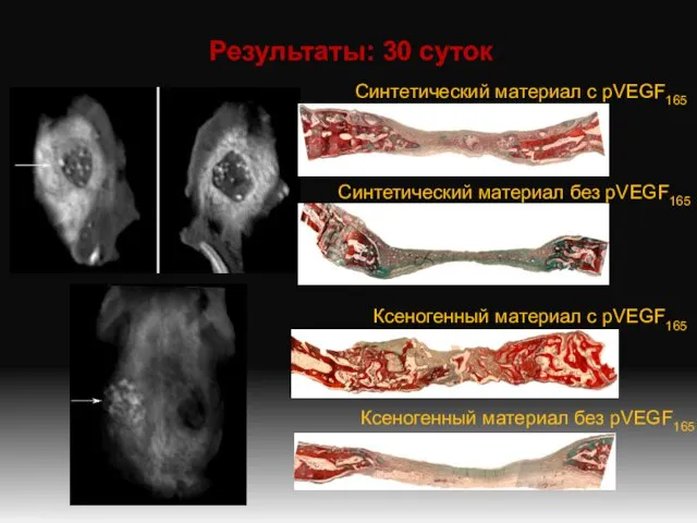 Результаты: 30 суток Синтетический материал с pVEGF165 Синтетический материал без pVEGF165 Ксеногенный