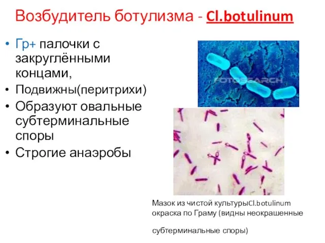 Мазок из чистой культурыCl.botulinum окраска по Граму (видны неокрашенные субтерминальные споры) Гр+