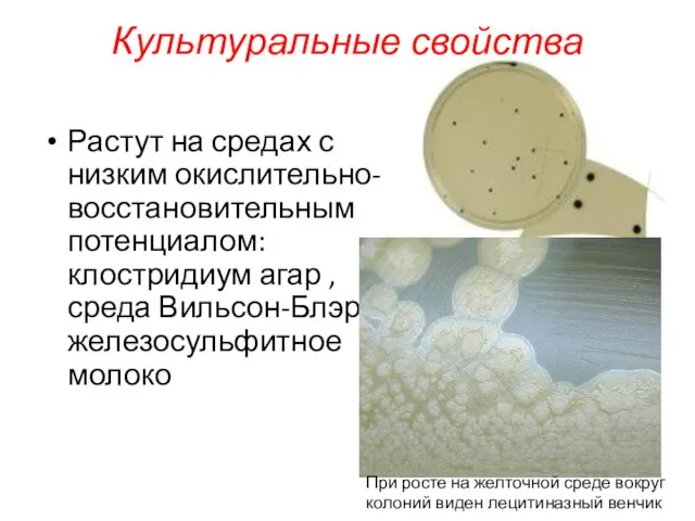 Растут на средах с низким окислительно-восстановительным потенциалом: клостридиум агар , среда Вильсон-Блэр