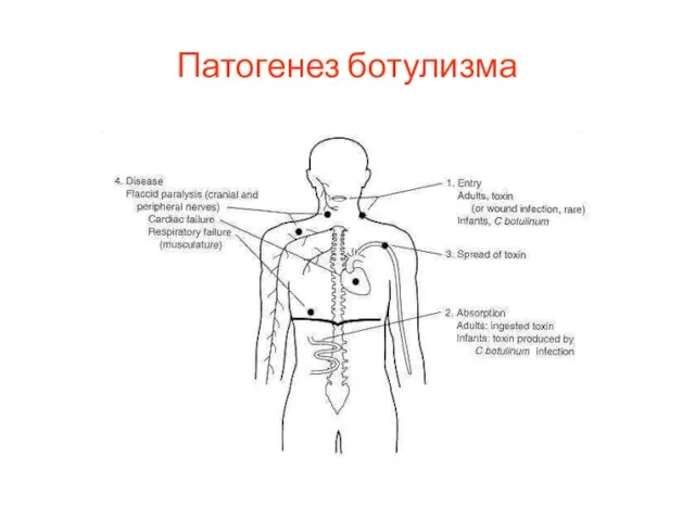 Патогенез ботулизма