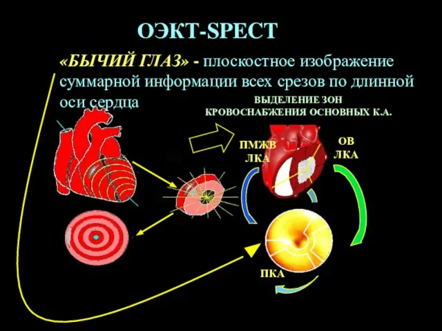 «БЫЧИЙ ГЛАЗ» - плоскостное изображение суммарной информации всех срезов по длинной оси