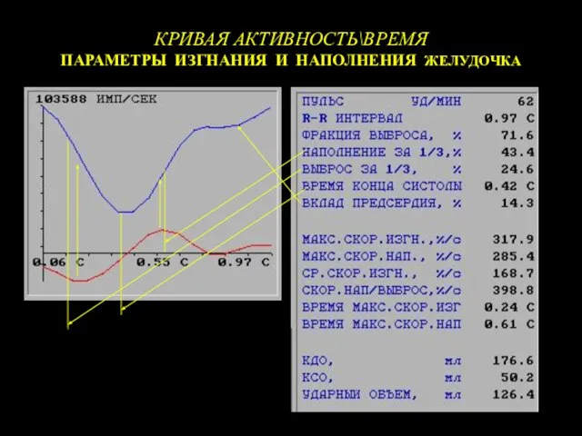 КРИВАЯ АКТИВНОСТЬ\ВРЕМЯ ПАРАМЕТРЫ ИЗГНАНИЯ И НАПОЛНЕНИЯ ЖЕЛУДОЧКА