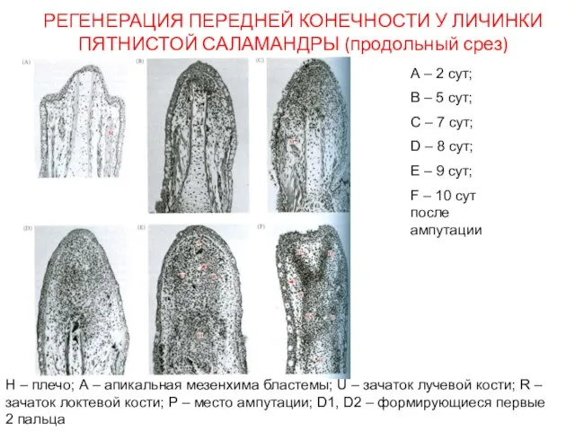 РЕГЕНЕРАЦИЯ ПЕРЕДНЕЙ КОНЕЧНОСТИ У ЛИЧИНКИ ПЯТНИСТОЙ САЛАМАНДРЫ (продольный срез) А – 2