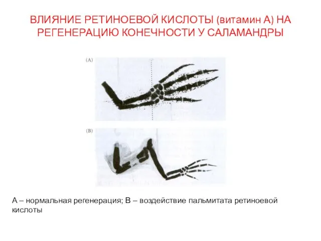 ВЛИЯНИЕ РЕТИНОЕВОЙ КИСЛОТЫ (витамин А) НА РЕГЕНЕРАЦИЮ КОНЕЧНОСТИ У САЛАМАНДРЫ А –