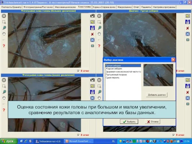 Оценка состояния кожи головы при большом и малом увеличении, сравнение результатов с аналогичными из базы данных.