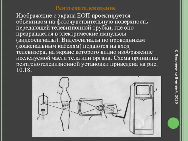 Рентгенотелевидение Изображение с экрана ЕОП проектируется объективом на фоточувствительную поверхность передающей телевизионной