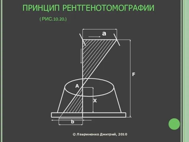 ПРИНЦИП РЕНТГЕНОТОМОГРАФИИ ( РИС.10.20.)‏ а А Х F b © Лавриненко Дмитрий, 2010