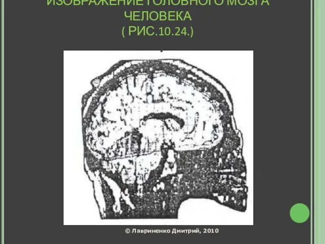 ИЗОБРАЖЕНИЕ ГОЛОВНОГО МОЗГА ЧЕЛОВЕКА ( РИС.10.24.)‏ © Лавриненко Дмитрий, 2010