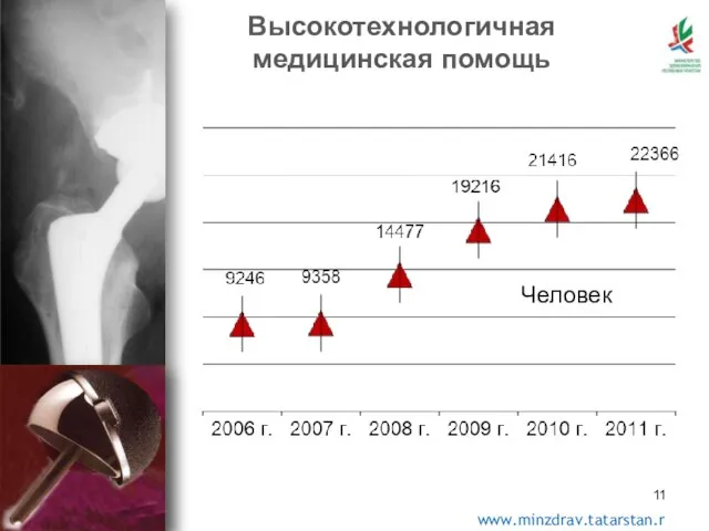 *прогноз Высокотехнологичная медицинская помощь Человек