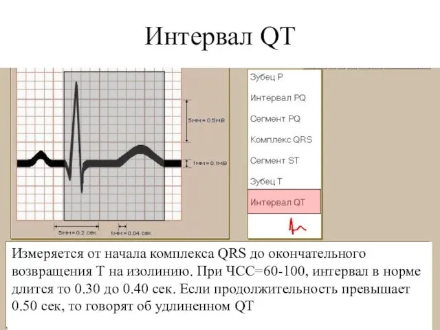 Интервал QT Измеряется от начала комплекса QRS до окончательного возвращения Т на