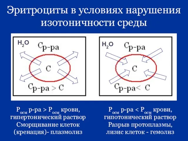 Эритроциты в условиях нарушения изотоничности среды Росм р-ра > Росм крови, гипертонический