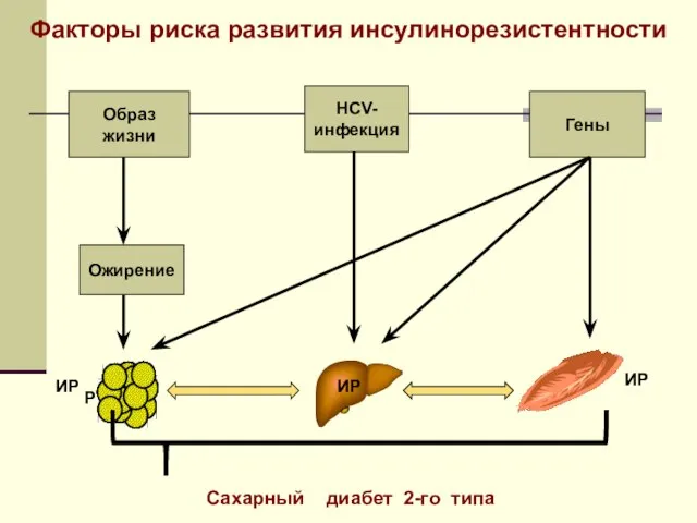 Образ жизни Ожирение HCV- инфекция Гены Сахарный диабет 2-го типа ИР ИР