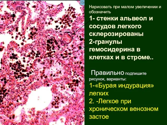 Нарисовать при малом увеличении и обозначить: 1- стенки альвеол и сосудов легкого