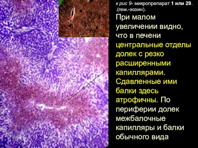 к рис 9- микропрепарат 1 или 29. .(гем.-эозин). При малом увеличении видно,