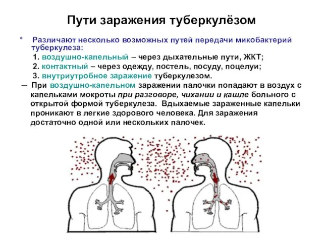 Пути заражения туберкулёзом ٭ Различают несколько возможных путей передачи микобактерий туберкулеза: 1.