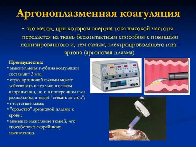 Аргоноплазменная коагуляция - это метод, при котором энергия тока высокой частоты передается