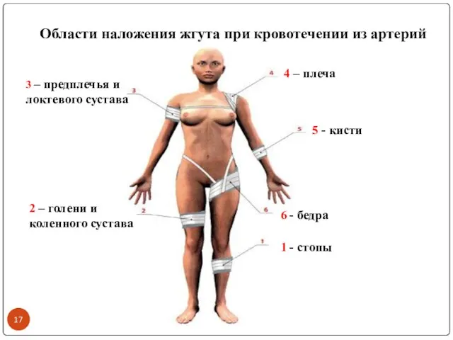 Области наложения жгута при кровотечении из артерий 1 - стопы 2 –