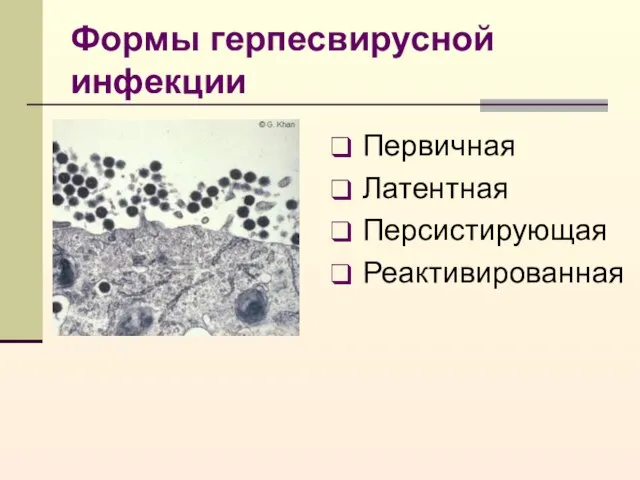 Формы герпесвирусной инфекции Первичная Латентная Персистирующая Реактивированная