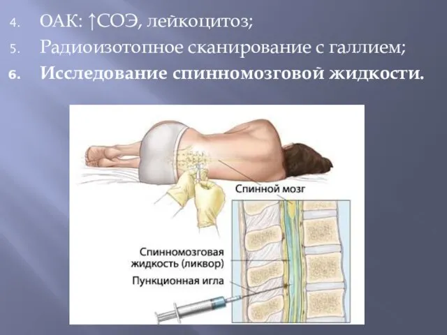 ОАК: ↑СОЭ, лейкоцитоз; Радиоизотопное сканирование с галлием; Исследование спинномозговой жидкости.