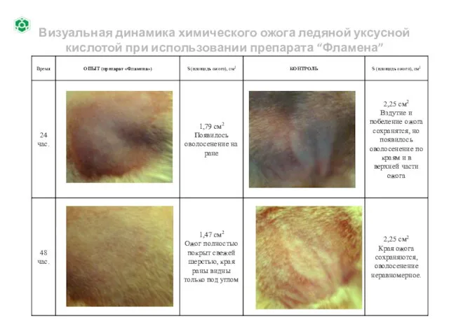 Визуальная динамика химического ожога ледяной уксусной кислотой при использовании препарата “Фламена”