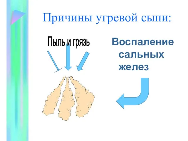 Причины угревой сыпи: Воспаление сальных желез Пыль и грязь