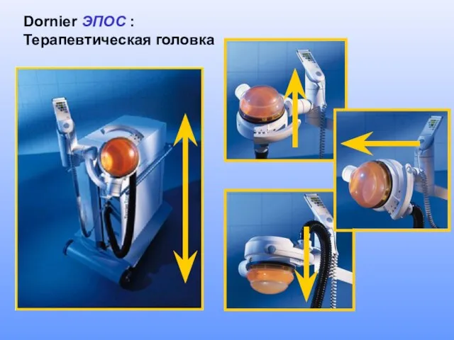 Dornier ЭПОС : Терапевтическая головка