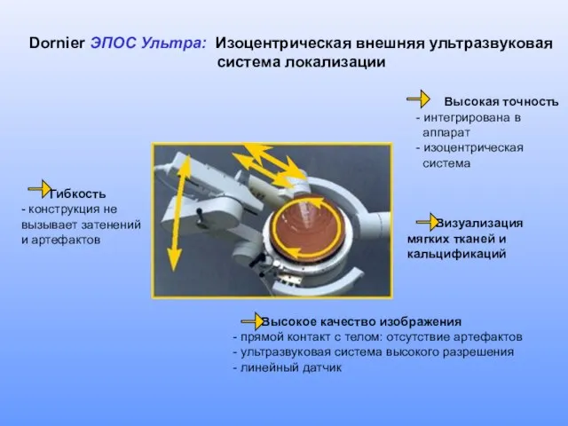 Dornier ЭПОС Ультра: Изоцентрическая внешняя ультразвуковая система локализации Высокое качество изображения -