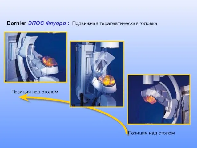 Dornier ЭПОС Флуоро : Подвижная терапевтическая головка Позиция над столом Позиция под столом