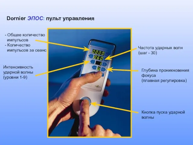 - Общее количество импульсов - Количество импульсов за сеанс Частота ударных волн