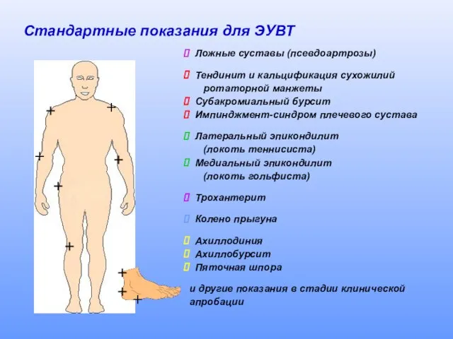 Стандартные показания для ЭУВТ Ложные суставы (псевдоартрозы) Тендинит и кальцификация сухожилий ротаторной