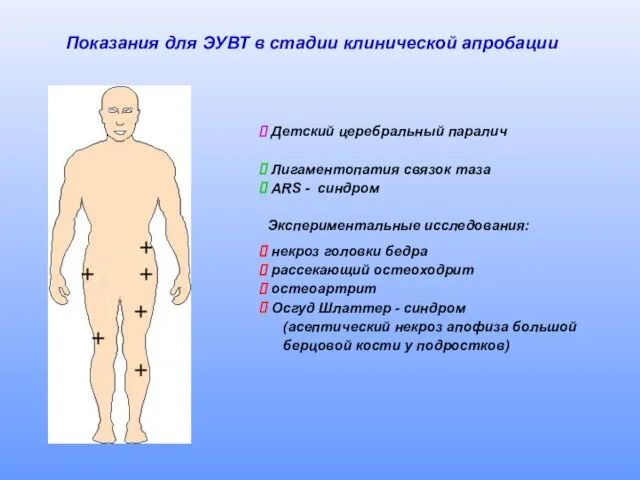 Показания для ЭУВТ в стадии клинической апробации Детский церебральный паралич Лигаментопатия связок