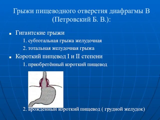 Грыжи пищеводного отверстия диафрагмы B (Петровский Б. В.): Гигантские грыжи 1. субтотальная