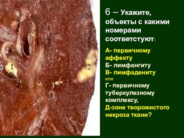 6 – Укажите, объекты с какими номерами соответстуют: А- первичному аффекту Б-