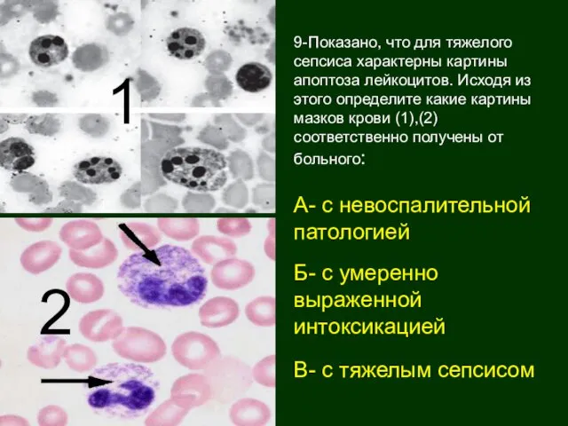 9-Показано, что для тяжелого сепсиса характерны картины апоптоза лейкоцитов. Исходя из этого