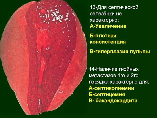 14-Наличие гнойных метастазов 1го и 2го порядка характерно для: А-септикопиемии Б-септицемия В-