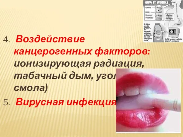 4. Воздействие канцерогенных факторов: ионизирующая радиация, табачный дым, угольная смола) 5. Вирусная инфекция.