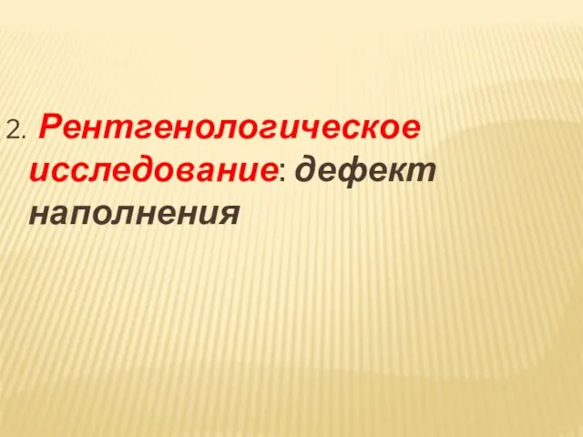 2. Рентгенологическое исследование: дефект наполнения