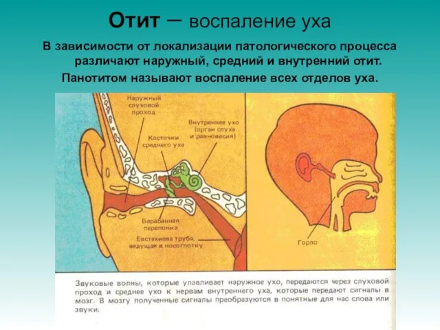 Отит – воспаление уха В зависимости от локализации патологического процесса различают наружный,