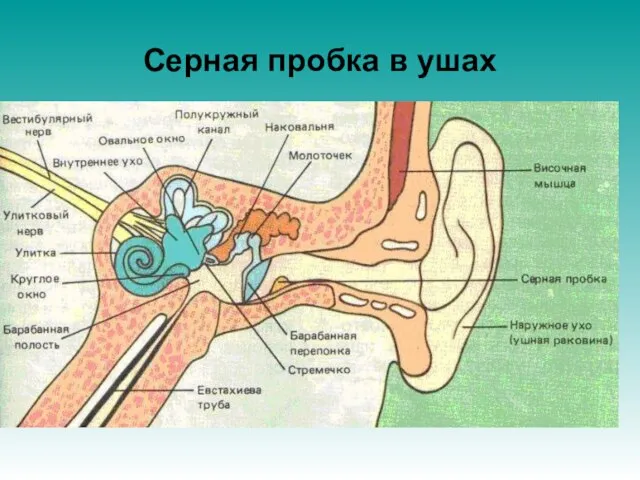 Серная пробка в ушах