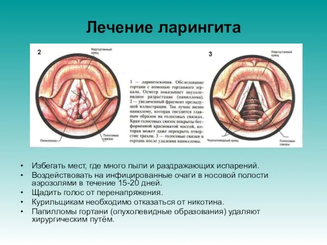 Избегать мест, где много пыли и раздражающих испарений. Воздействовать на инфицированные очаги