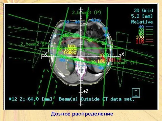 Дозное распределение